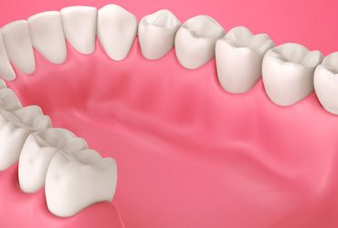 Periodontal Gum Treatment