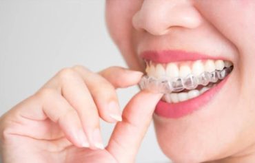 Invisalign & Dental Braces