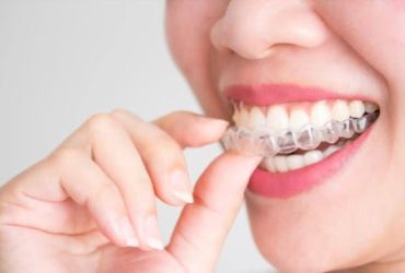 Invisalign & Dental Braces