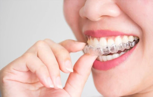invisalign berwick