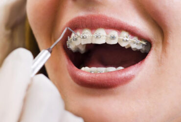 Orthodontics