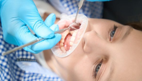 Can a Dentist Repair Receding Gums? Here’s Everything You Need to Know